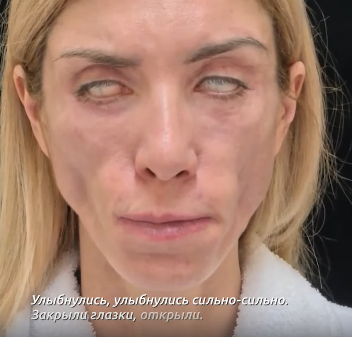 Жительница Сочи оказалась изуродована после пластической операции ВИДЕО