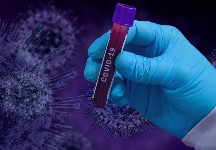 На Кубани за минувшие сутки выявлено 187 новых случаев коронавируса 