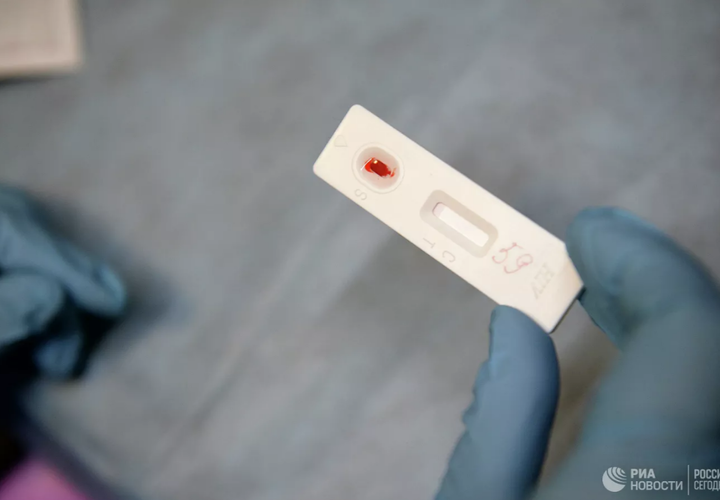 Вакцина от коронавируса вызвала ложные результаты на ВИЧ-инфекцию