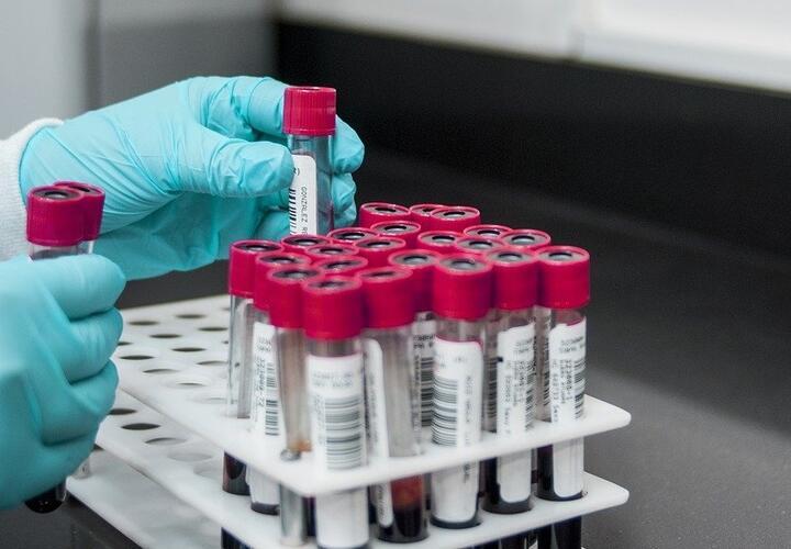 В Краснодарском крае впервые с марта коронавирус выявили у 123 человек