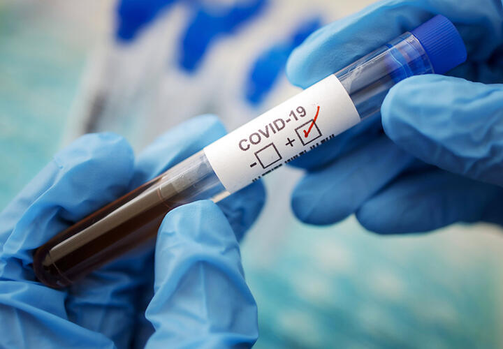 На Кубани вновь антирекорд по количеству заболевших COVID-19