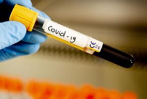 Кубань в антирейтинге регионов по уровню коллективного иммунитета к COVID-19