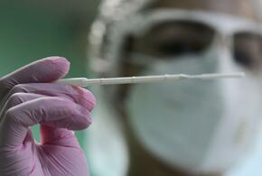 На Кубани выявили еще 173 случая заражения коронавирусом