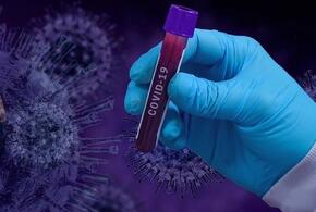 На Кубани за минувшие сутки выявлено 187 новых случаев коронавируса 