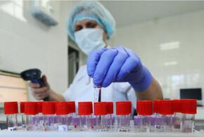 В Краснодарском крае еще 96 человек заболели коронавирусом