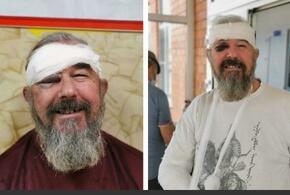 На Кубани полицейские дважды сломали руку 60-летнему мужчине, который не хотел надевать маску? ВИДЕО