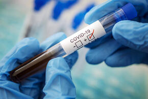 В Краснодарском крае зафиксировали 814 новых случаев коронавируса