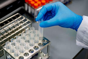 За сутки на Кубани выявлено 144 новых случая коронавируса