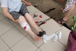 В Краснодаре пенсионерка изрезала ногу о строительную плитку на крыльце