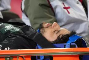 Бразильский легионер «Краснодара» получил серьезную травму головы в игре со «Спартаком»