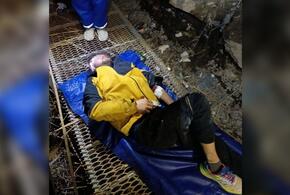 В Анапе мужчину, упавшего с лестницы «300 ступеней», спасатели не смогли привести в сознание